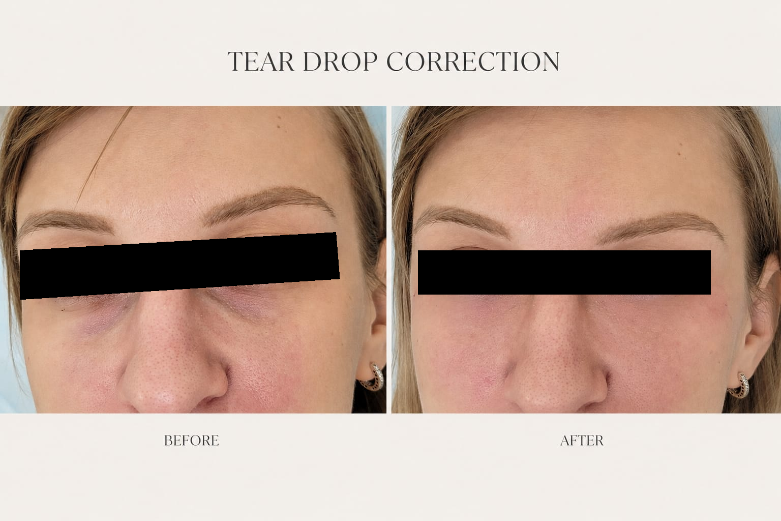 Under Eye Correction, before on the left and after on the right